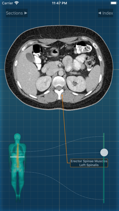 X-Anatomy Pro Screenshot