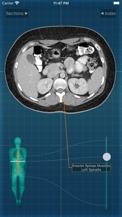 X-Anatomy Proのおすすめ画像7