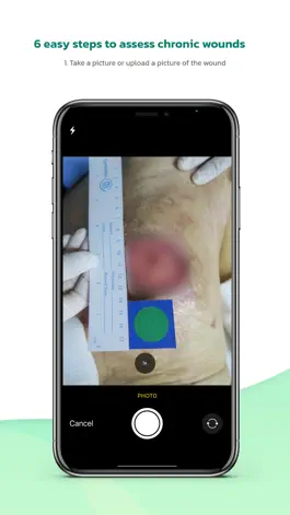 Game screenshot WoundSee hack
