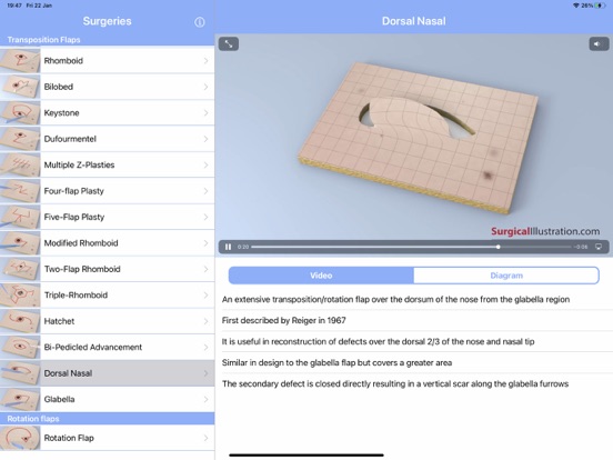 Screenshot #6 pour Surgical Flaps