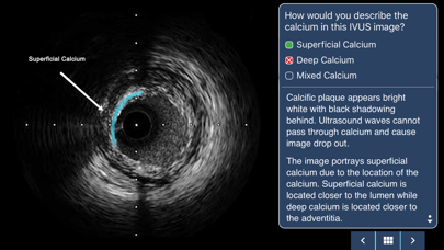 IVUS + Physiology Pro Screenshot