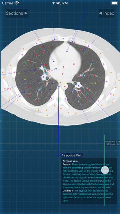 X-Anatomy Pro Screenshot