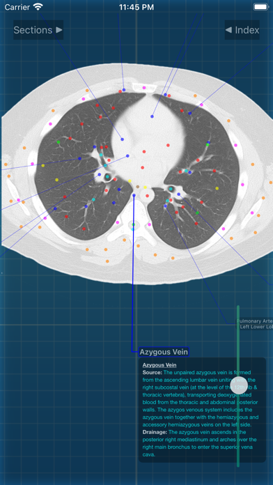 X-Anatomy Proのおすすめ画像6