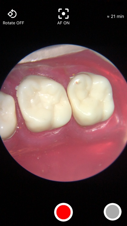 SOVA (Special On View App)