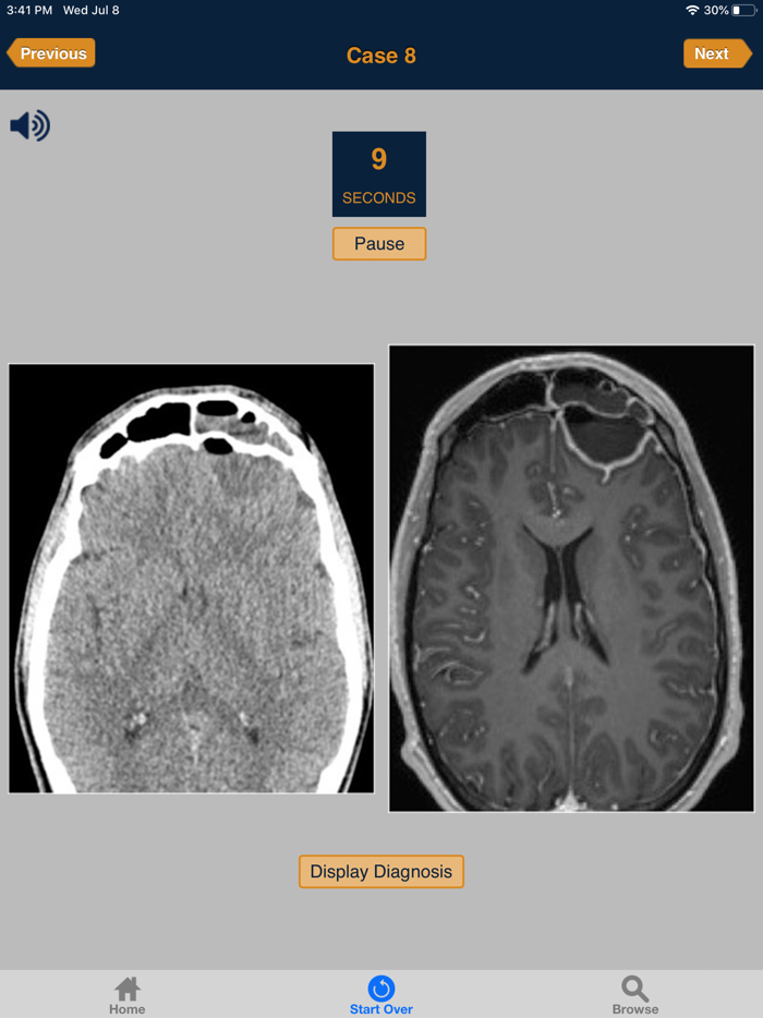 CTisus 10 Minute ER Challenge