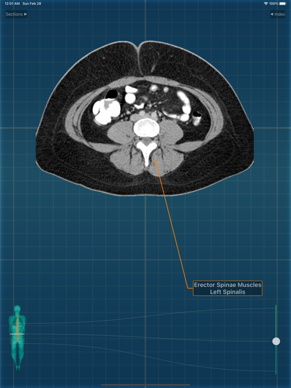 X-Anatomy Proのおすすめ画像7