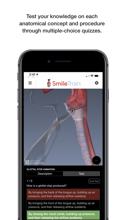 Smile Train screenshot-4