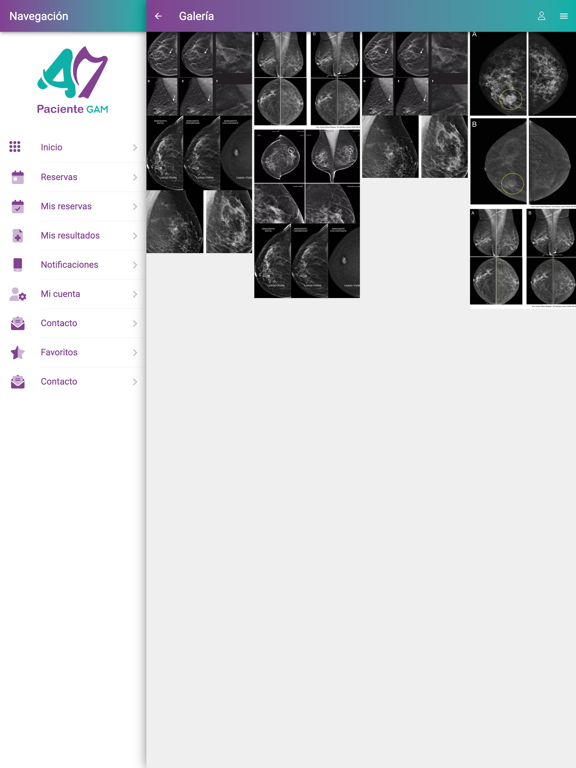 Screenshot #6 pour Paciente GAM