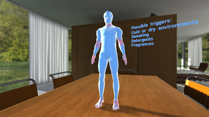 Managing Atopic Dermatitis