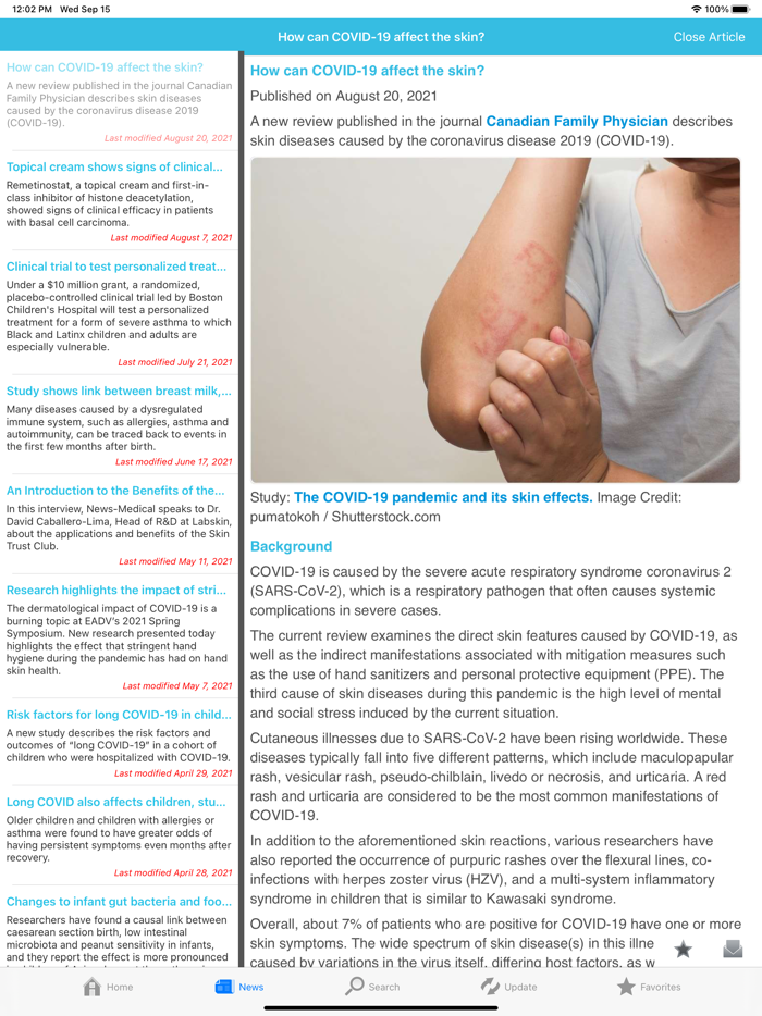 Eczema by AZoMedical