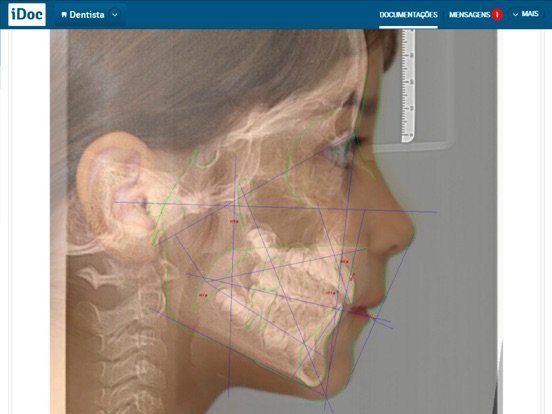 Screenshot #5 pour Multi Face