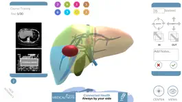 Game screenshot LIVER-NOTE.Edu apk