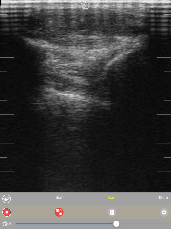 Screenshot #5 pour Tecnoscan Connect