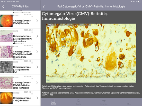 Screenshot #6 pour Atlas of Ophthalmology