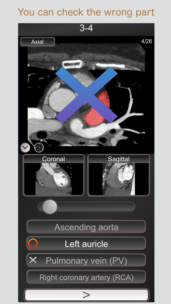 CT PassQuiz Heart - MRI
