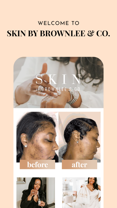 Skin By Brownlee Screenshot