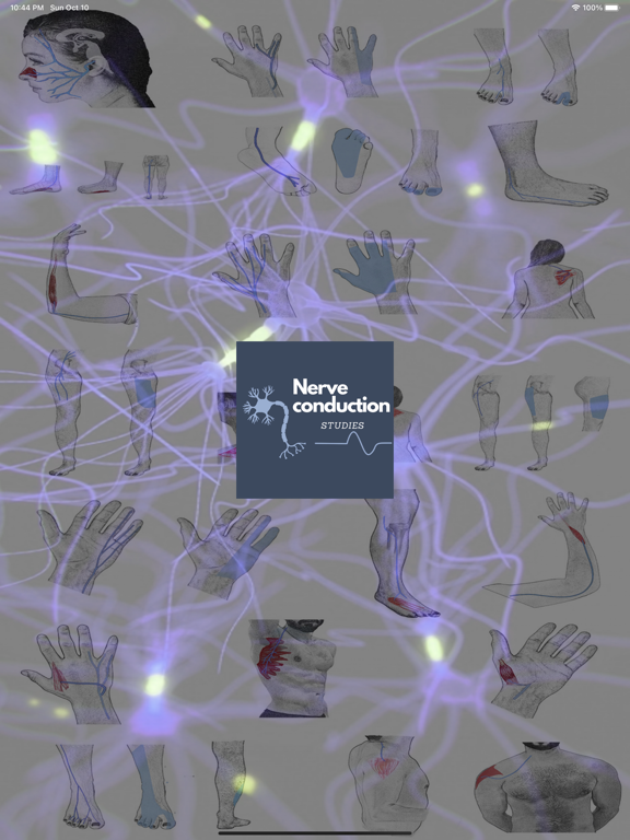 Screenshot #5 pour Nerve Conduction Studies