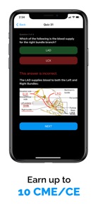 ECG / EKG Explained Clearly screenshot #5 for iPhone