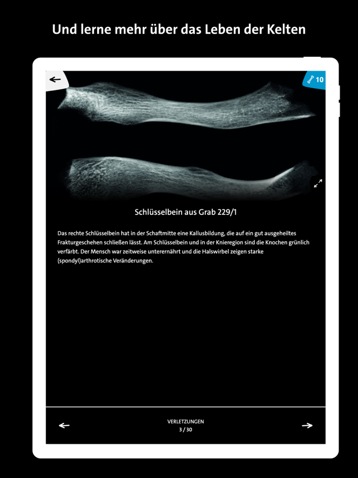 Keltenmuseum Hallein