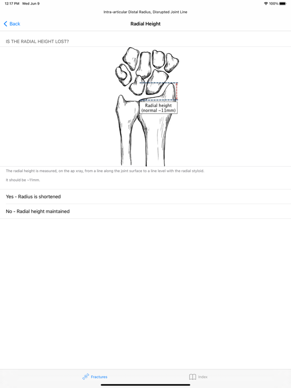 Screenshot #5 pour OrthoFlow