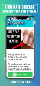 Find Nail Disease screenshot #2 for iPhone