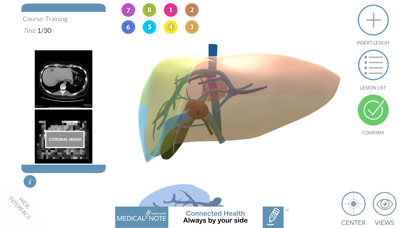 LIVER-NOTE.Edu Screenshot