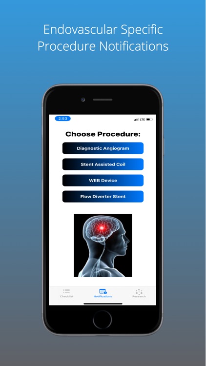 Endovascular Neurosurgery