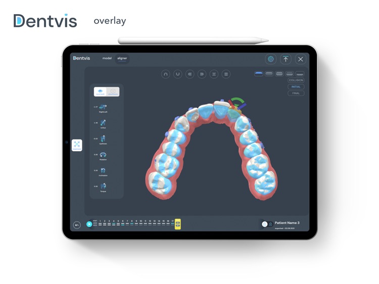 DentVis screenshot-4