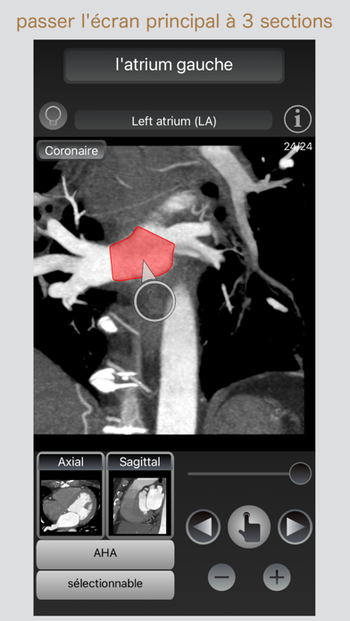 Screenshot #3 pour CT Passeport Coeur / IRM / MRI