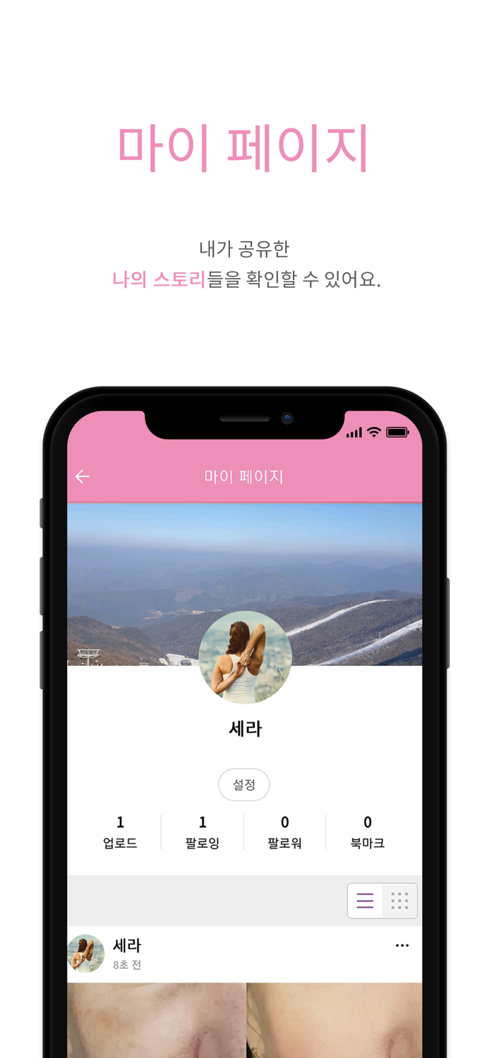 성형 판 - 성형 정보 공유 커뮤니티