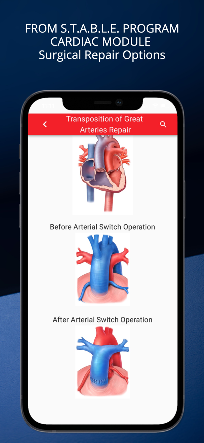 STABLEize for HealthStream