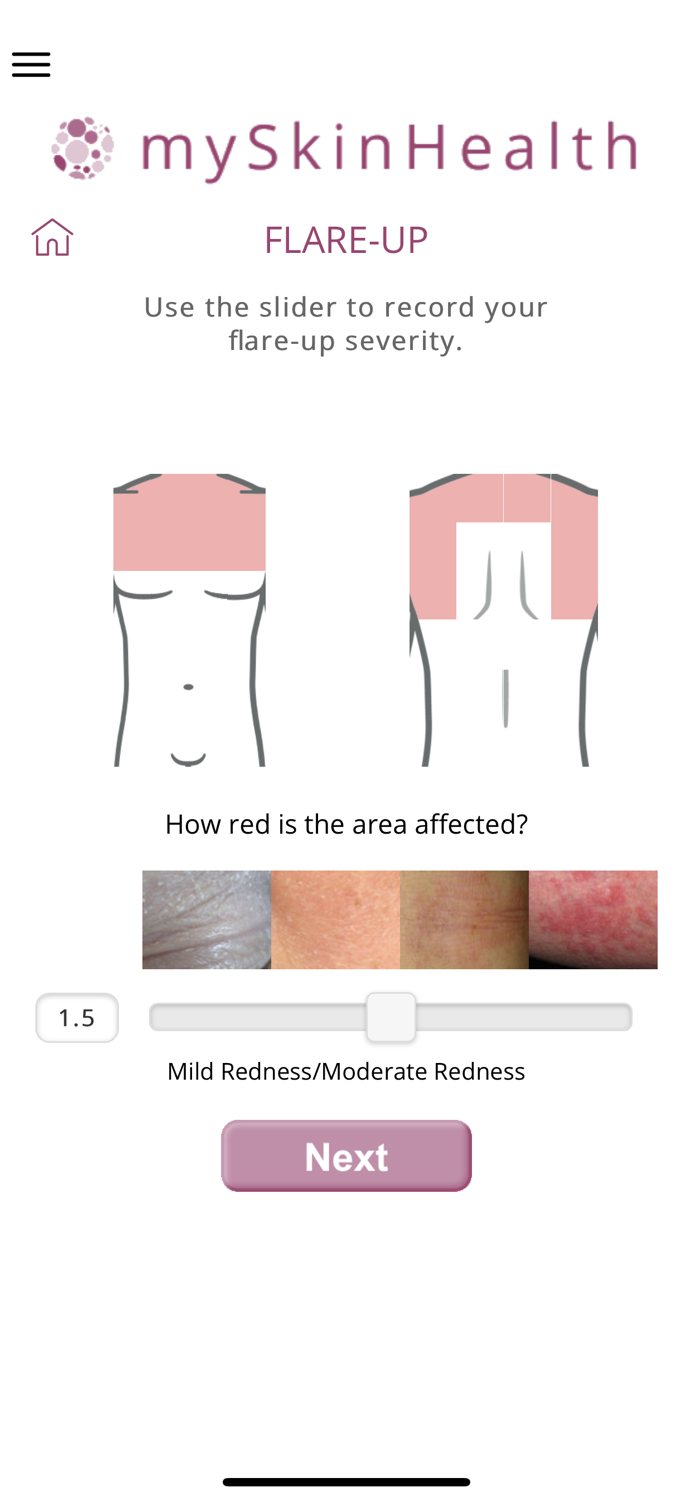 mySkinHealth - Eczema