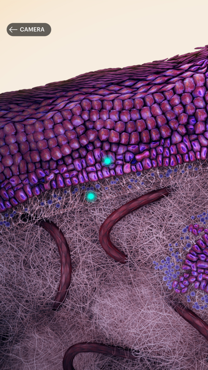 Actinic Keratosis AR