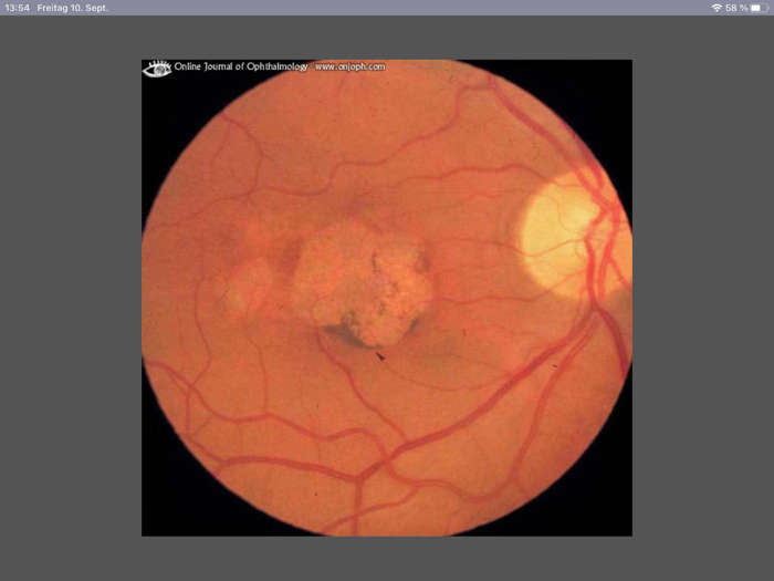 Atlas of Ophthalmology