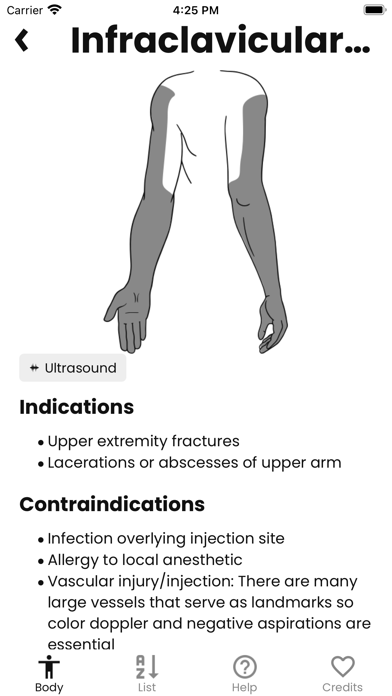 Nerve Block Screenshot