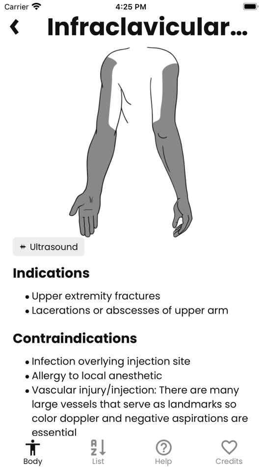 #5. Nerve Block (iOS) By: Tom Fadial