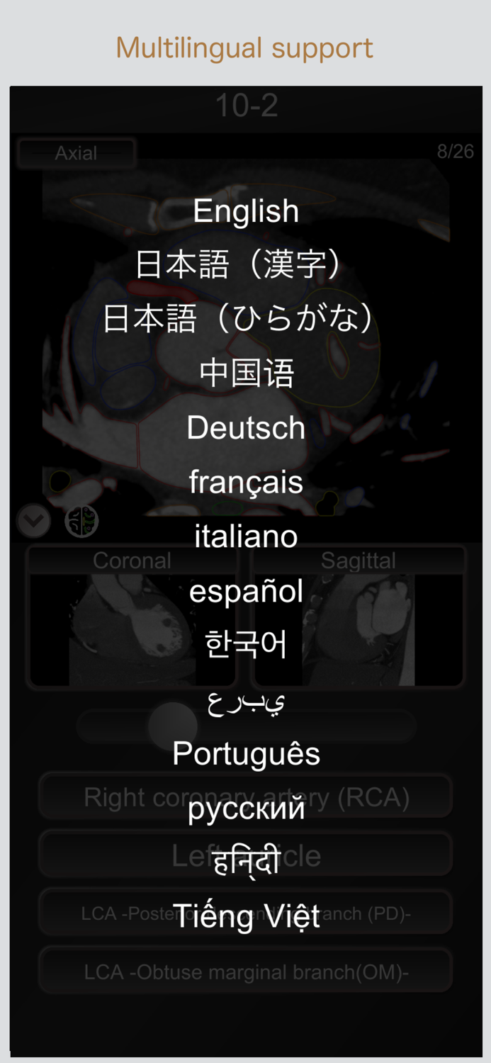 CT PassQuiz Heart - MRI
