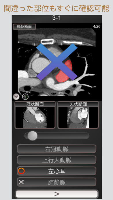 CT PassQuiz 心臓 / MRI screenshot1
