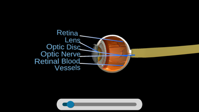 Anti-VEGF’s in DR, AMD & RVO Screenshot