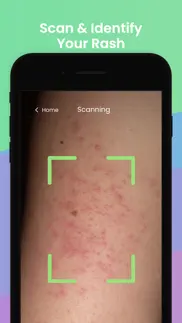 rash id - rash identifier iphone screenshot 1