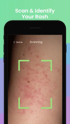 Game screenshot Rash ID - Rash Identifier mod apk