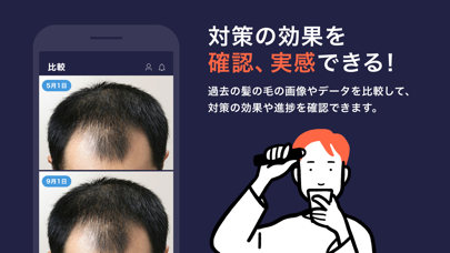 スマホカメラで薄毛・頭皮チェック、増毛にはHIX（ヒックス）のおすすめ画像6