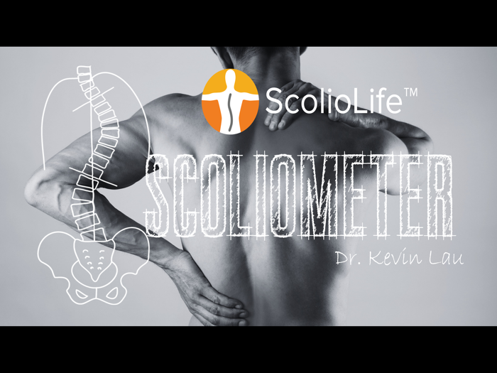 Scoliometer