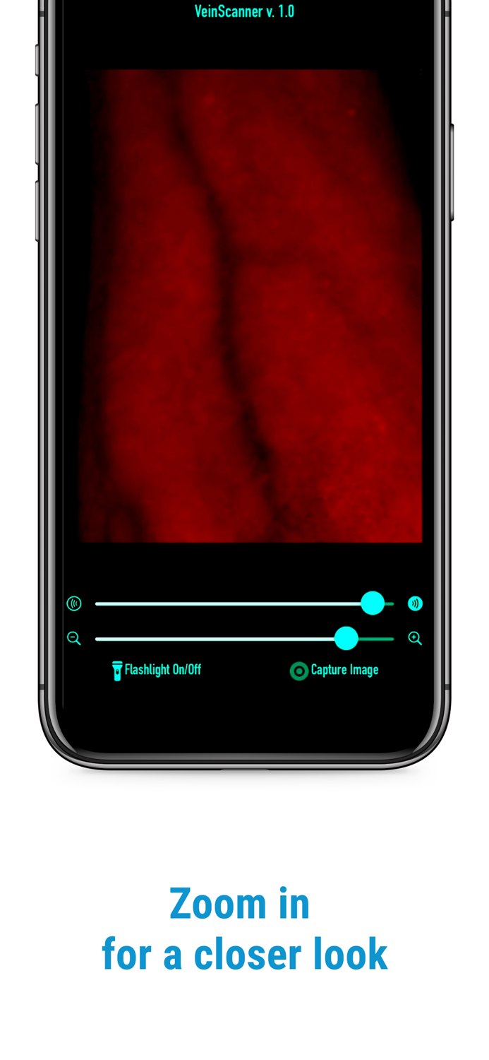 VeinScanner