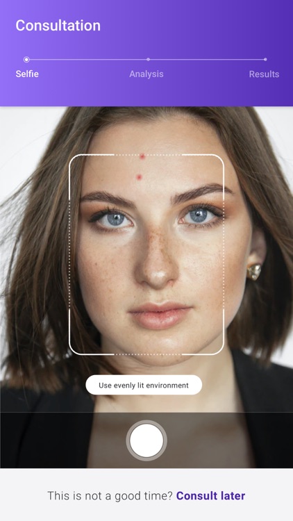 Acne Intelligence