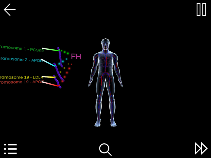 Familial Hypercholesterolemia