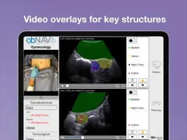 Game screenshot obNAV: Ultrasound Education hack