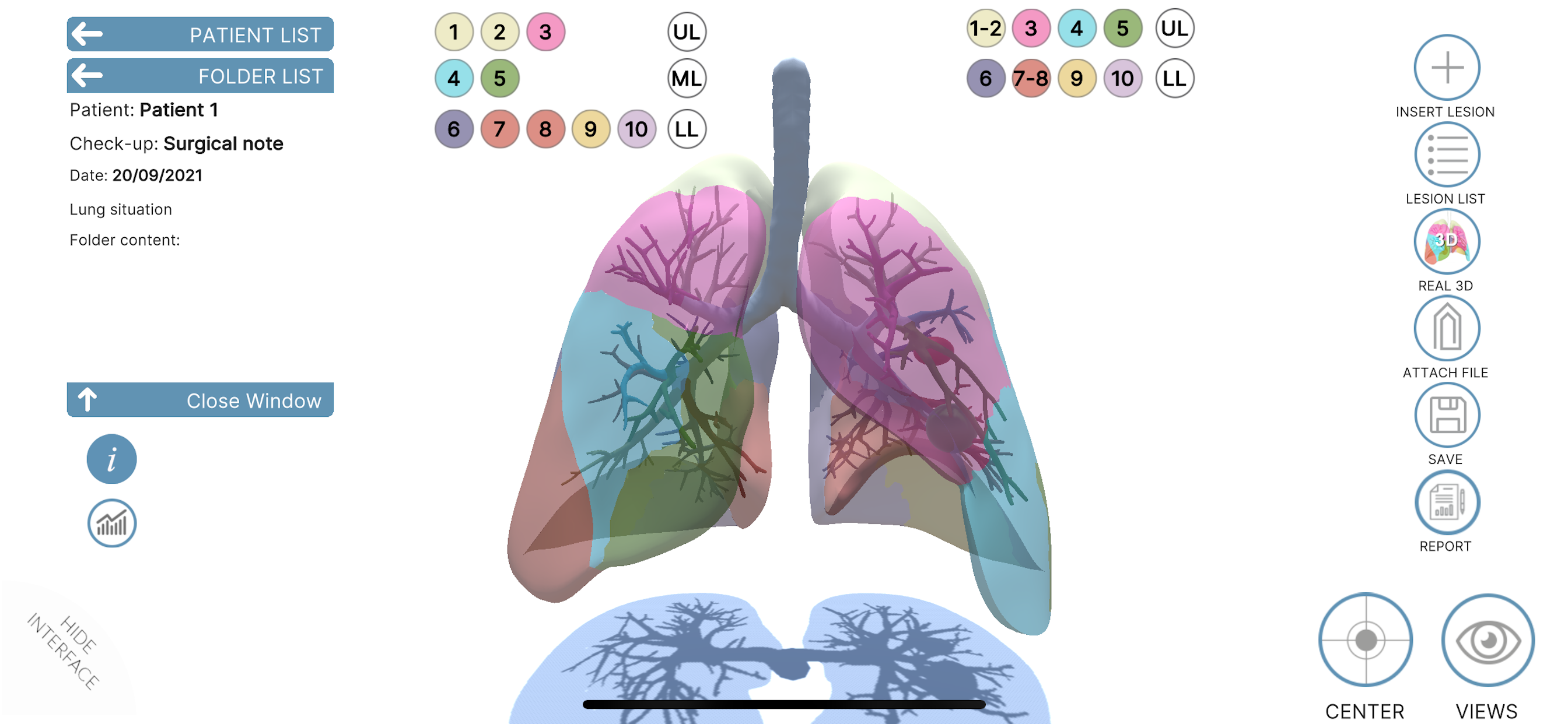 LUNG-NOTE
