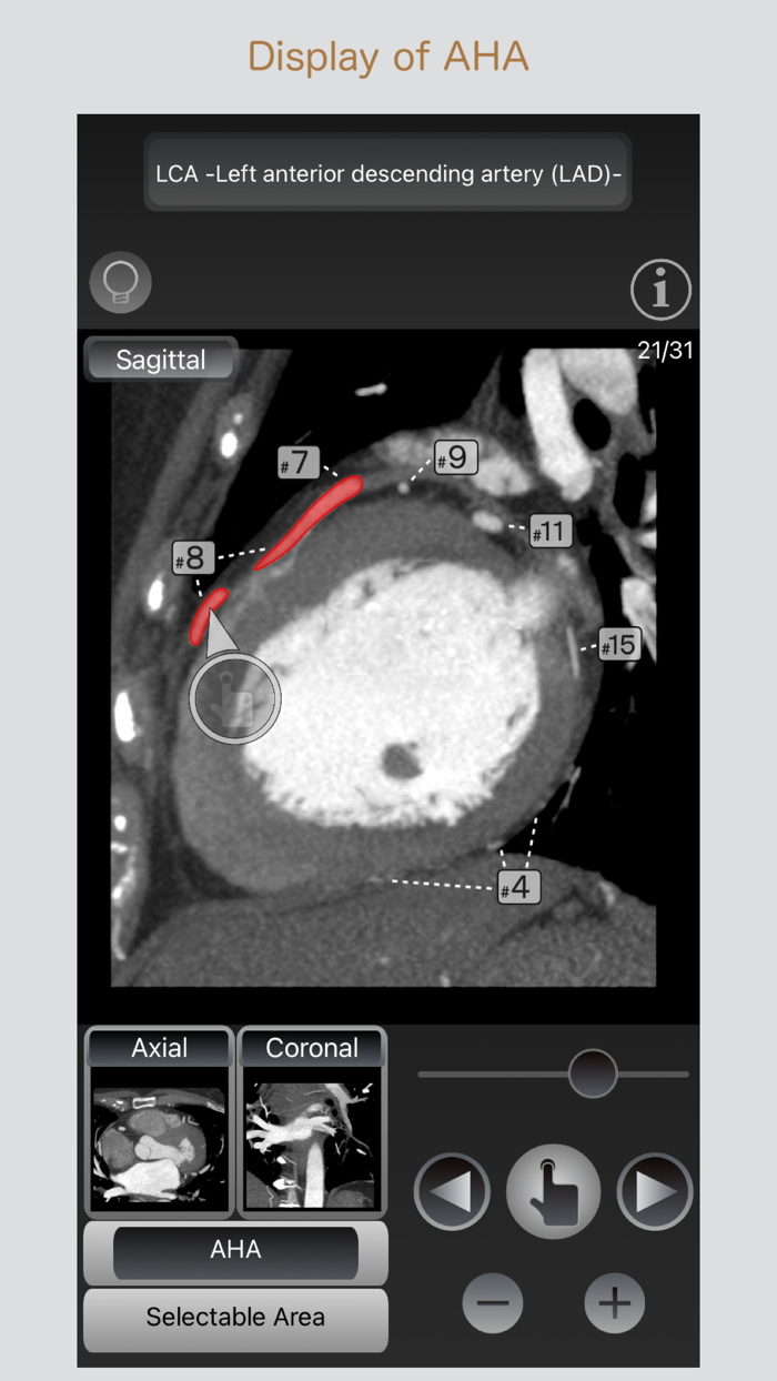 CT Passport Heart / MRI