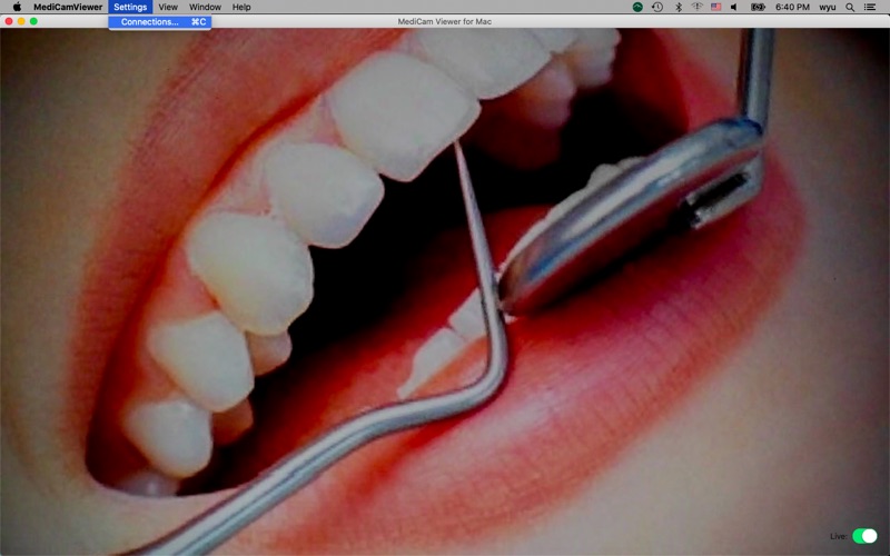 Screenshot #3 pour MediCam Viewer